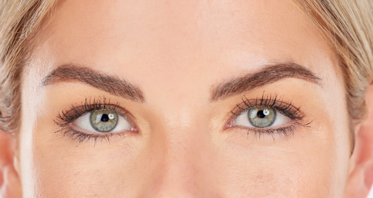 Brow Lift me Toksinë Botulinike
