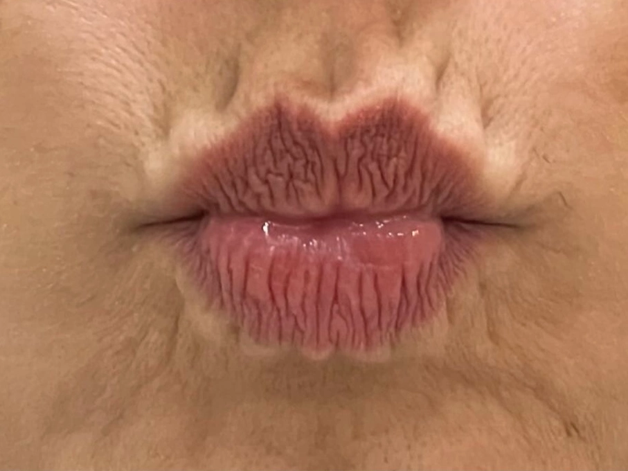 Para